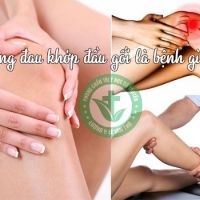 Địa Chỉ Trị Sưng Đau Khớp Đầu Gối Bằng Đông Y